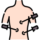 Laparoscopy